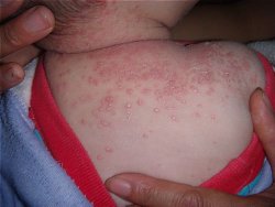 ��������ôԤ��ţƤѢ