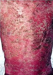 ţƤѢ����Ӧ����ô��