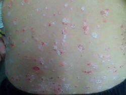 ţƤѢ��֢״��ɶ