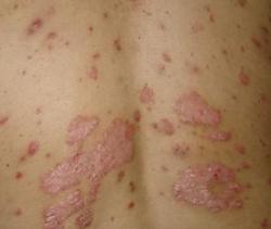 ţƤѢ����ƫ��