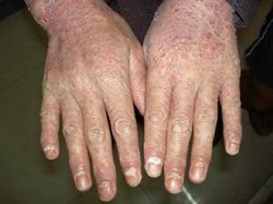 ţƤѢ���ܳ�ʲô����