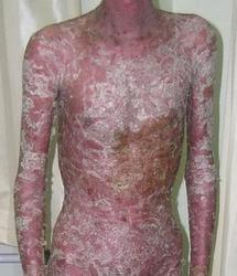 ��ͯ��ţƤѢ�Ĳ���