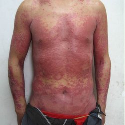 ��ҽ���������Ʒ�������ţƤѢ��