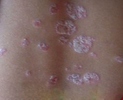 ��ô�ܹ�����ţƤѢ�Ĳ���