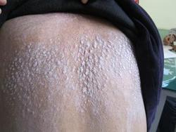 ţƤѢ������Ҫ��ʳ��ʲô