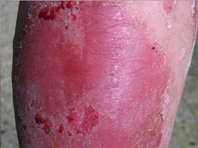 ţƤѢ����ϴ��ʱע������