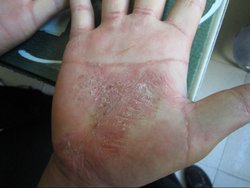 ţƤѢ��ʳ��ʲôҪ��