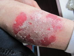 ��ô�ܹ����װ���ţƤѢ